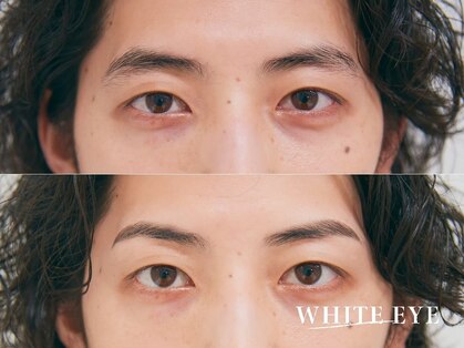 ホワイトアイ 仙台店(WHITE EYE)の写真