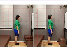 摂津本山駅前鍼灸整骨院/ビフォーアフターになります！