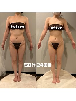 ソウソウビューティー 五反田(Shou Shou Beauty)/ビフォー★アフター　24回目