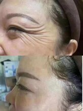 イーズン(Easen)/