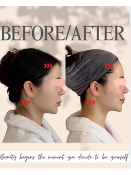 エイエービジュー(Aa.bijou)/20代 女性