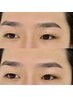 迷っている方はこちら◎あなたに合うメニューをプロがご提案！