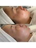 肌別トリートメント 90分　22,000