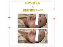 ラウレア(Laule'A)