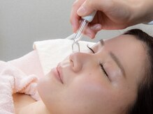 エミル(CP)/毛穴改善