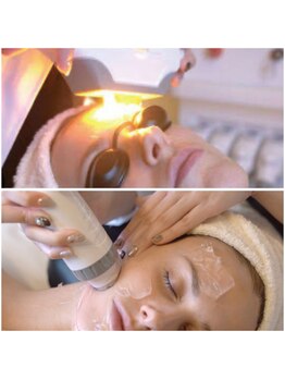 ウッドベル(WOODBELL)の写真/Eライトでシミ、くすみケア5,000円→4,000円ICE RFでたるみケア5,000円→4,000円透明感のあるハリツヤ肌に