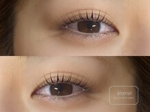 エテェネル(eternel)/パリジェンヌラッシュリフト