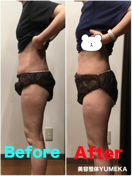 美容整体ユメカ(美容整体YUMEKA)/骨盤ダイエット+骨盤ストレッチ