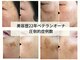 ムーンアンドアース(moon&earth)の写真