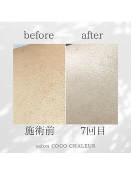 ココ シャルール(salon COCO CHALEUR)/Before　After