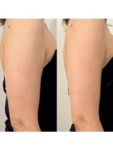 リム ビューティー(RYM BEAUTY)/最新超音波