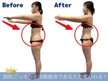 ワクワクボディクリニック 二俣川店(WAKUWAKU BODY CLINIC)の雰囲気（ハイパーナイフで痩身ダイエット＆たるみ改善！ブライダルも◎）