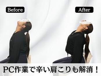 ハリユナイテッド 原宿鍼灸 整体院(HALI UNITED)/PCで辛い肩こりも解消!
