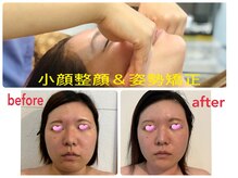 ボタニカル小顔整体(botanical小顔整体)
