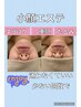 瞬時に目で見て分かる小顔エステ60分★エラ張り/むくみ/二重顎改善で理想小顔