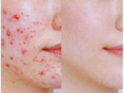 フルリールの写真