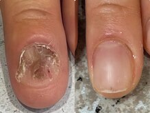 グラシナ 鳥丸店/