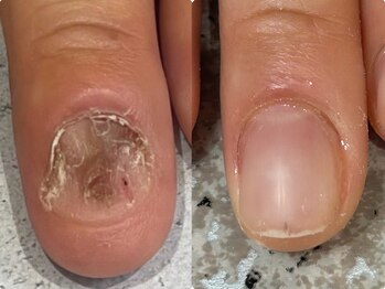 グラシナ 鳥丸店/