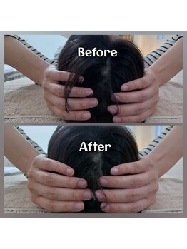 ぷめはな整体/before/After