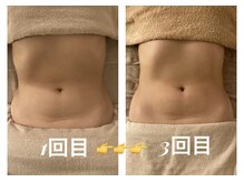 フルールドソレイユ(Fleur de Soleil)/回数を重ねると驚きの効果実感♪