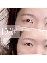 エールラッシュカール 森ノ宮(aile lash curl)/ダブルアイリフト