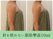 ソルニスデュオ(Solnis.-duo-)/痩身/酵素浴/毛穴/よもぎ蒸し