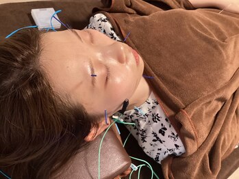 ハリファ鍼灸院 横浜関内院(HariFa鍼灸院)/美容施術/美容鍼