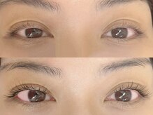 シクラプ(siklap)/リフエク100本