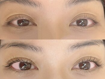 シクラプ(siklap)/リフエク100本