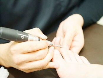 かがわ接骨院 高松伏石院/巻き爪でお悩みの方へ！