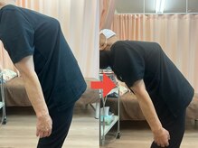 腰痛が一度の施術でしっかり動くようになっています。