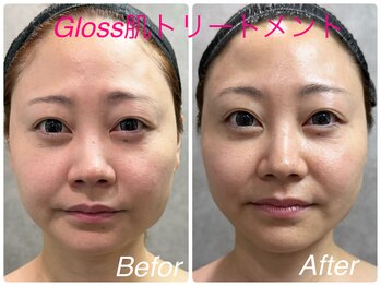 ココプラス(COCO+)/【NEW】Gloss肌トリートメント