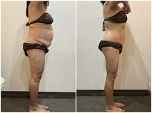 ウェリナ平和堂長久手院/小顔矯正/骨盤矯正/美脚サロン