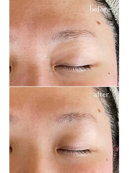 ニコテ(Nicote)/肌育ボンバーフェイシャル