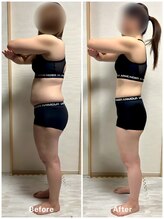 リスタート整体院 鹿児島(Restart整体院)/Restart痩身&ダイエット