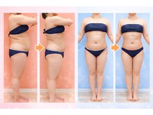 ハンズ鍼灸接骨院小牧院 美容整体ハンズ(美容整体hands)の雰囲気（骨盤矯正×ハイパーナイフ×電磁パルスの痩身プログラムセット）