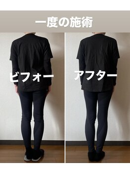 西野6条はり灸整骨院の写真/身体の芯から疲れを取り、美姿勢へ♪敷居の低いサロンでリラックス。部屋着での来店もOK◎