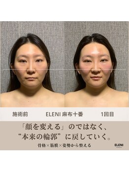 エレーニ 麻布十番(ELENI)/本来の本来の輪郭に戻していく。