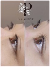 シキ(SIKI)/パリジェンヌ前と後