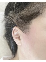 ワックスラボ(WAXLAB)/横顔美人☆ &nbsp;もみあげ脱毛　　