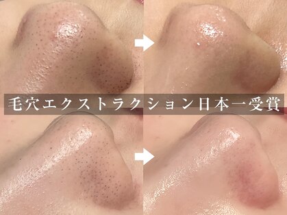 ティーティービューティー(TT Beauty)の写真