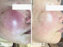 スウ(su:)/赤みもここまで引いた！