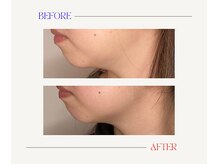 はりと美容鍼灸治療院(HaRi&美容鍼灸治療院)/