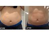 ＜メンズ痩身＞ビール腹と決別！脱げる体へ徹底痩身！人から見られる快感を