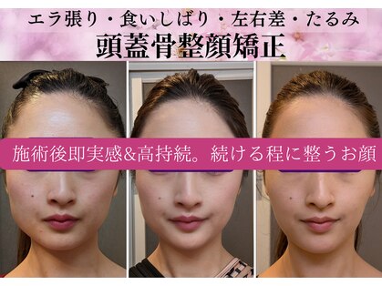 ヴォーチェ(VOCE)の写真
