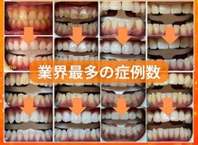 ホワイトニングセンター 谷山店