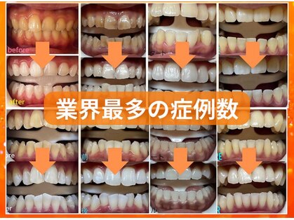 ホワイトニングセンター 谷山店の写真
