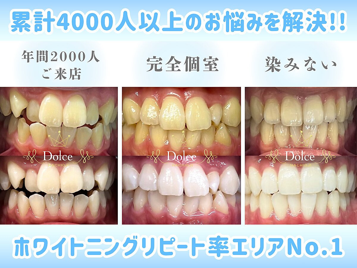 ドルチェ 水戸店(Dolce)｜ホットペッパービューティー