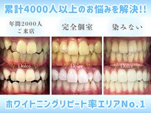 ドルチェ 水戸店(Dolce)の雰囲気（初回から効果を実感できる。しっかり白くしたいならDolce。）