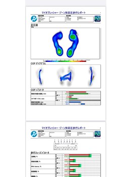 メディカルジャパン 吉祥寺/1万人以上の歩行分析を実施